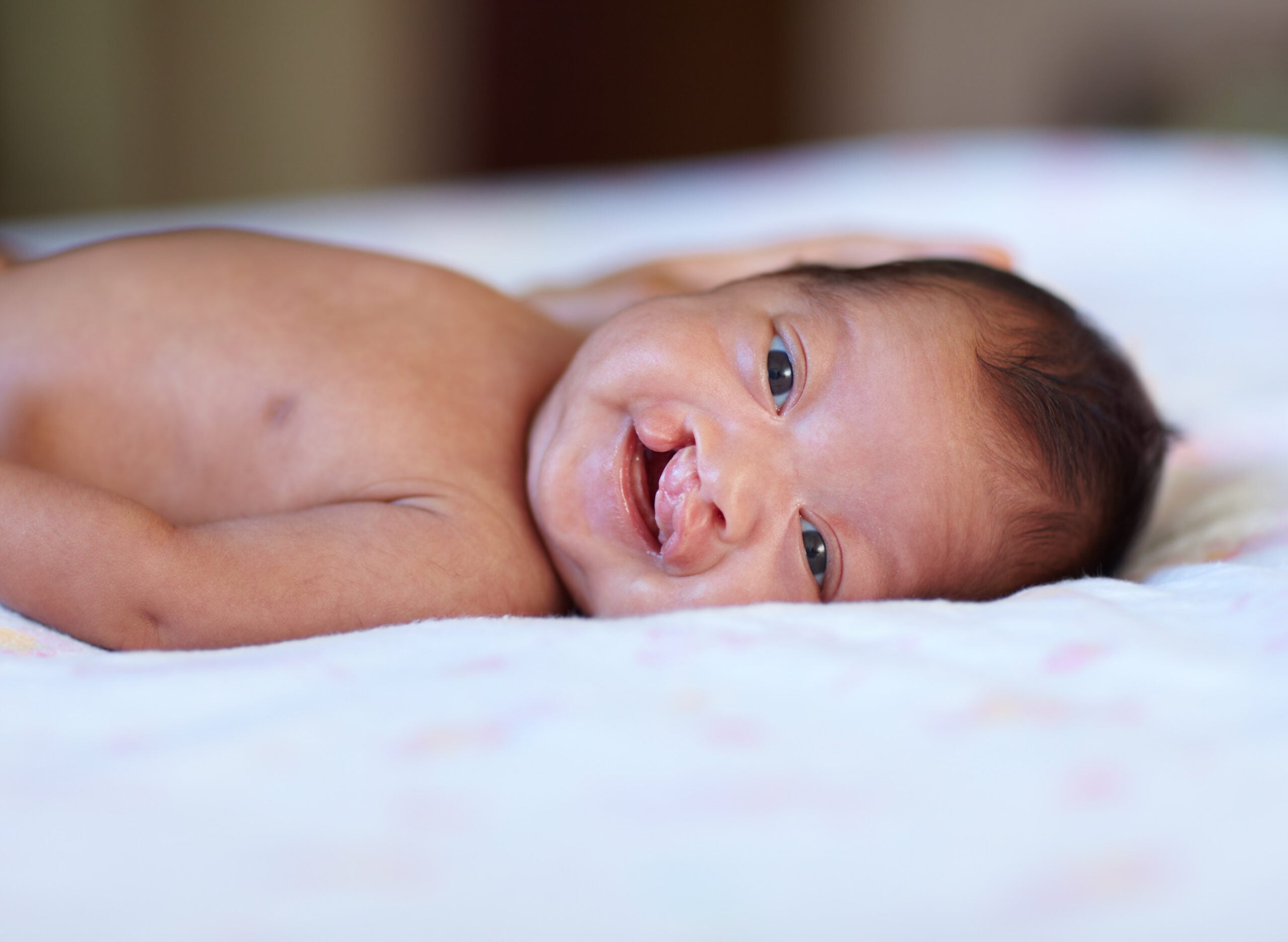A baby with a cleft lip is lying on their back on a bed, looking at the camera and smiling.