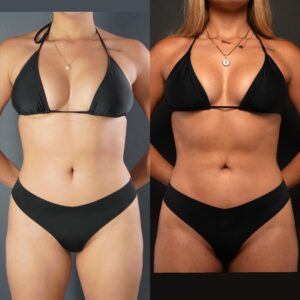 Two women wearing black bikinis stand side by side against plain backgrounds, both facing forward with arms at their sides. Their faces are not visible, creating a minimalist yet striking composition reminiscent of contemporary works featured in Dr Moores Gallery.